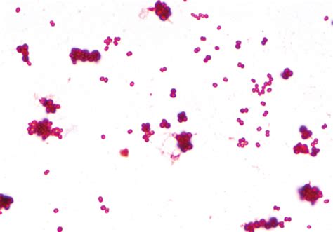 chlamydia gram stain results|Gram Stain: Reference Range, Interpretation, .